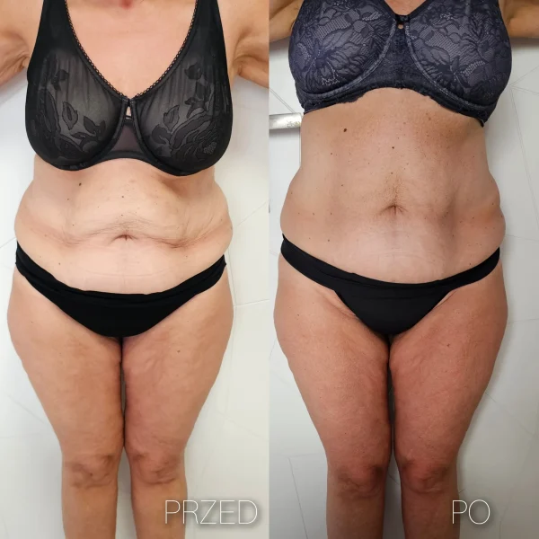 5. Magnifico II Premium