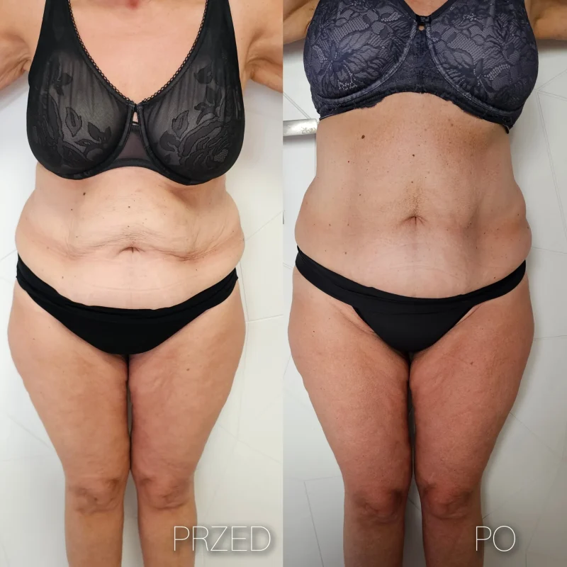 5. Magnifico II Premium